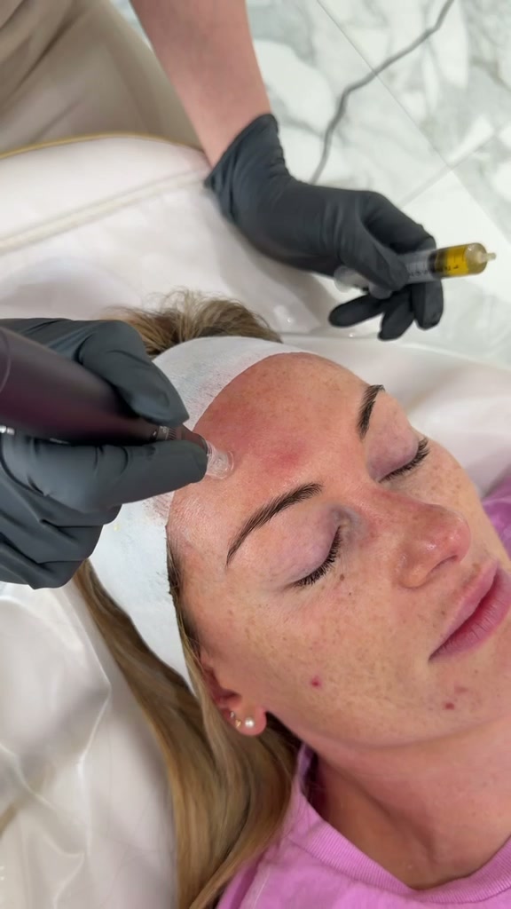 PRP Plasma